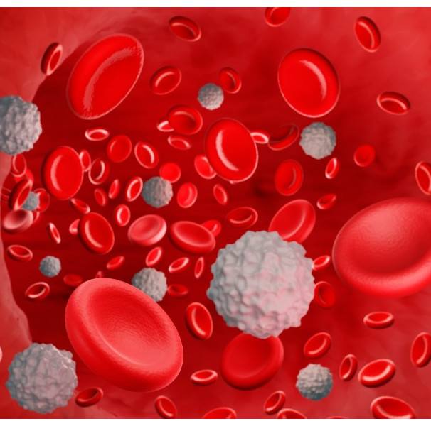 Leucemia Mieloide Aguda: Sintomas, Tratamentos E Causas - Minha Vida