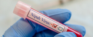 Imagem de um tubo de ensaio com sangue e uma etiqueta indicando que o teste deu positivo para vírus Nipah
