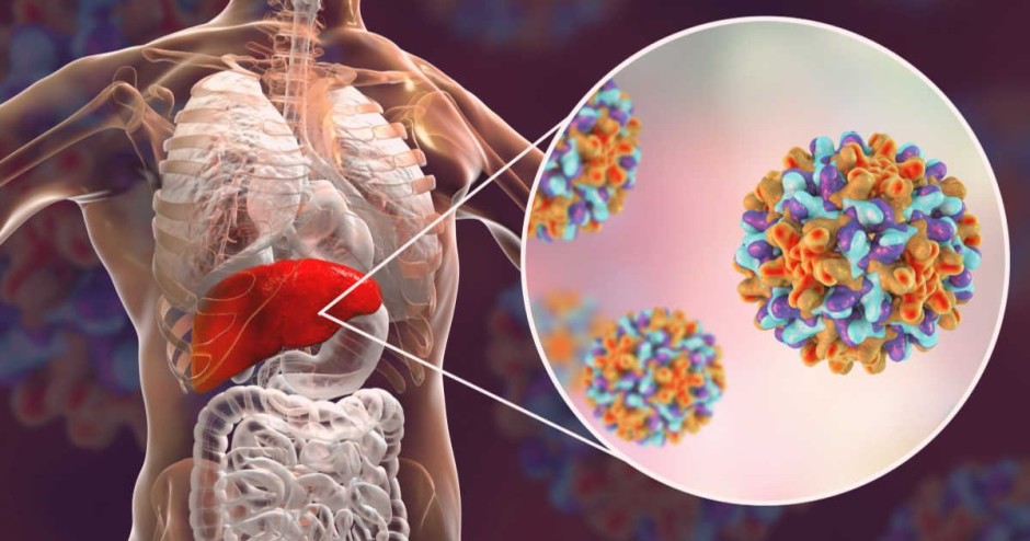 Hepatite B é uma infecção viral no fígado - Foto: Shutterstock