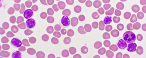 representação gráfica das células sanguíneas