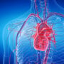 Miocardiopatia dilatada