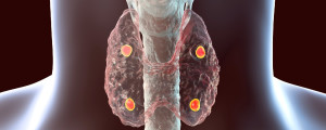 images das glângulas paratirodais do corpo humano