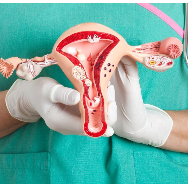 Foto de Sintoma De Endometriose Sangue Menstrual Com Coágulos De