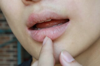 Pessoa com boca seca - Foto:&nbsp;Wonderplay/Shutterstock
