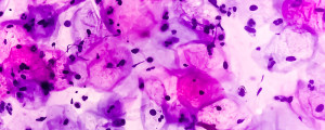 Visão microscópica das células do colo do útero