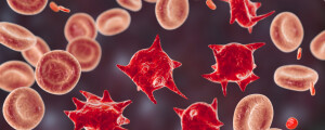 Glóbulos vermelhos anormais de acantócitos