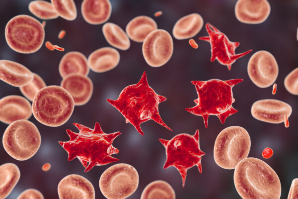 Glóbulos vermelhos anormais de acantócitos