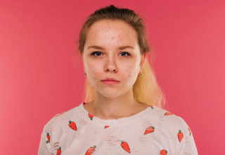 Apesar de ser mais comum na infância, adolescentes e adultos também podem apresentar catapora - Foto: Shutterstock
