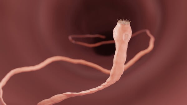 Ilustração que mostra verme tênia em tom rosado no intestino humano.
