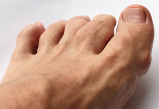 Homem com gota nas articulações dos pés - Foto: Shutterstock