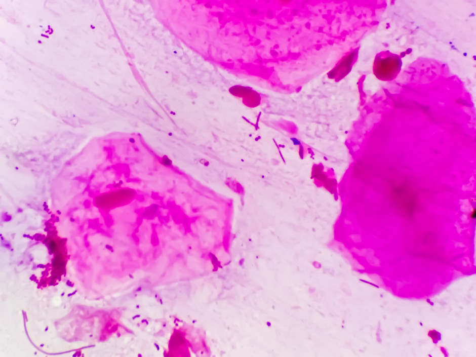imagem microscópica da bactéria causadora da gonorreia