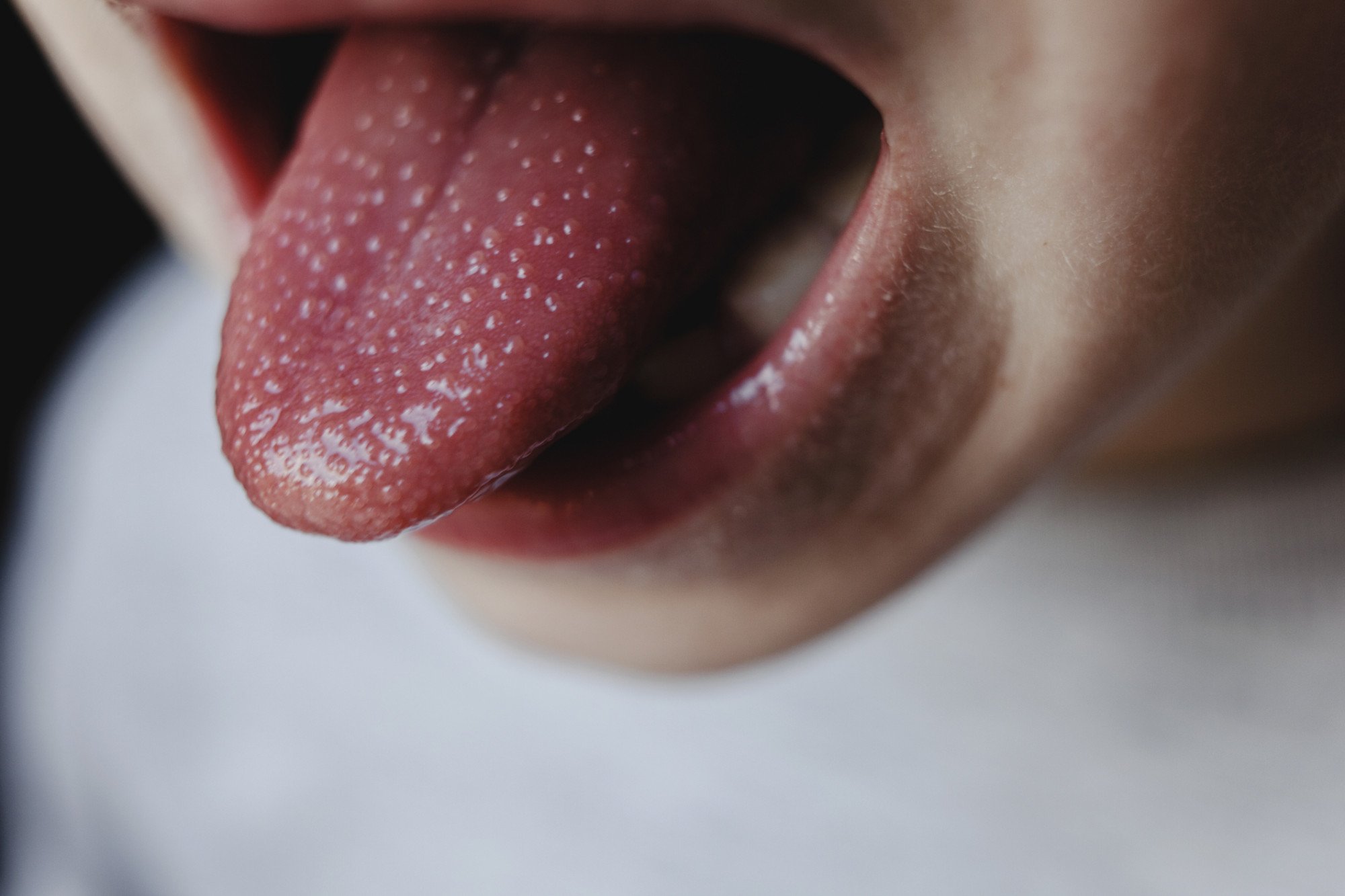 Saiba quais são as principais causas das bolinhas na língua