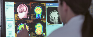 Médica olhando para um monitor que mostra uma imagem em Raio X do cérebro