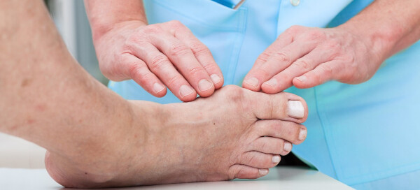 ortopedista analisando pé com joanete