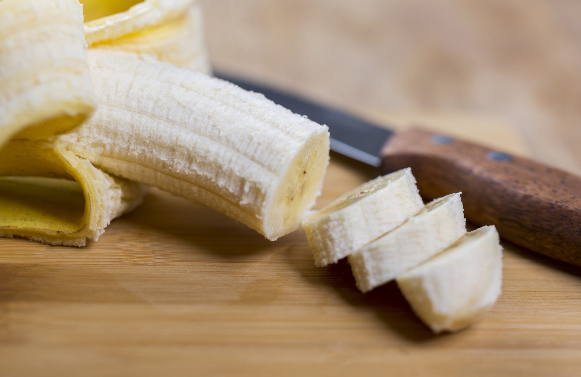 Banana: conheça os tipos, benefícios e receitas - Minha Vida
