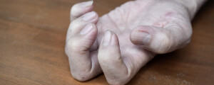 mão em formato de garra