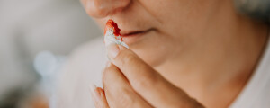 Pessoa com sintomas de sangramento no nariz