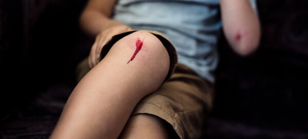 Joelho sangrando