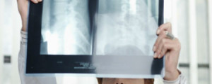 médica olhando um raio-x