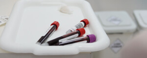 tubos de sangue coletado em cima de uma bacia branca em um laboratório médico