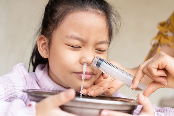 Criança asiática fazendo lavagem nasal com uma seringa com soro fisiológico; a mãe insere a seringa no nariz da filha, que segura uma tigela de alumínio