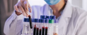 Profissional médico em laboratório segurando amostrar de coleta de sangue