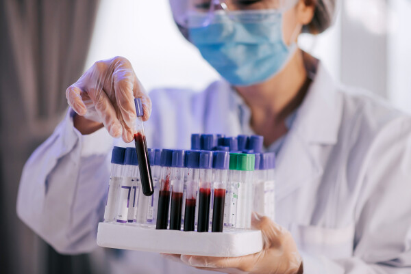 Profissional médico em laboratório segurando amostrar de coleta de sangue