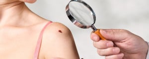Médico examinando mulher com melanoma