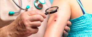Médico examinando mulher com melanoma
