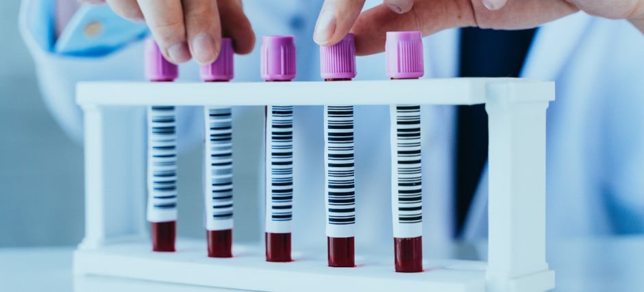 tubos de amostra de sangue em uma fileira para análise laboratorial
