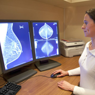 Mamografia digital tem imagem exibida no computador - Foto: Getty Images