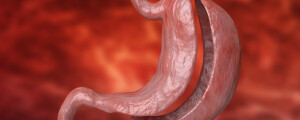 Ilustração de um estômago sob um fundo vermelho. O órgão apresenta uma divisão que evidencia uma parte retirada dele