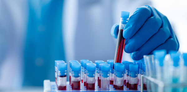 Mão com luva de laboratório coloca um tubo de ensaio com amostra de sangue entre outras amostras